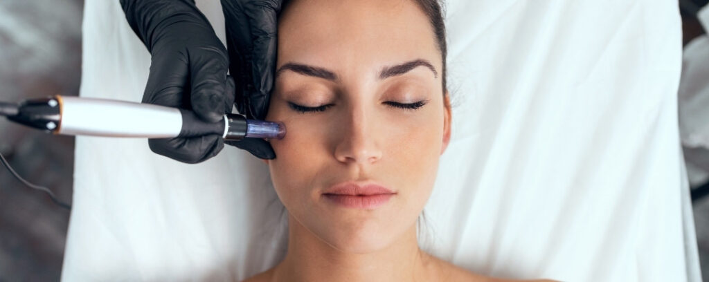 Dermapen tratamiento en Alicante microneedling