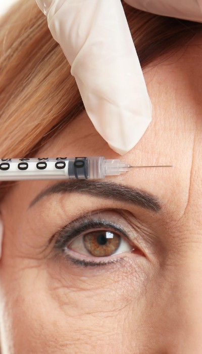 botox para arrugas en alicante botox para arrugas en alicante
