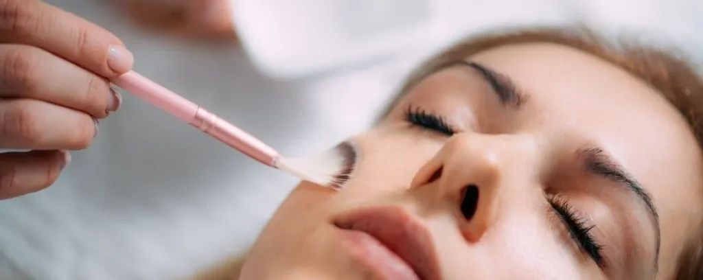 Aplicación de peeling químico facial con brocha en una clínica estética, tratamiento de exfoliación para mejorar manchas, arrugas y textura de la piel.