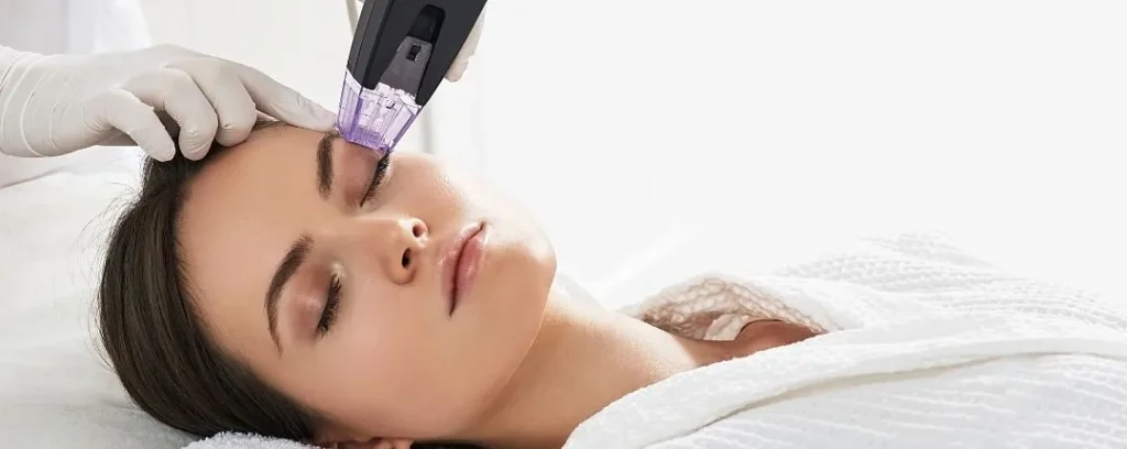Aplicación de **microneedling facial** en la frente a una paciente tumbada en una cabina de estética.