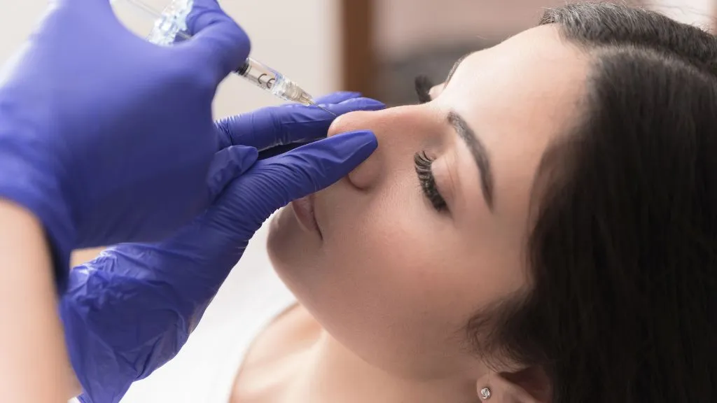 Rinoplastia sin cirugía