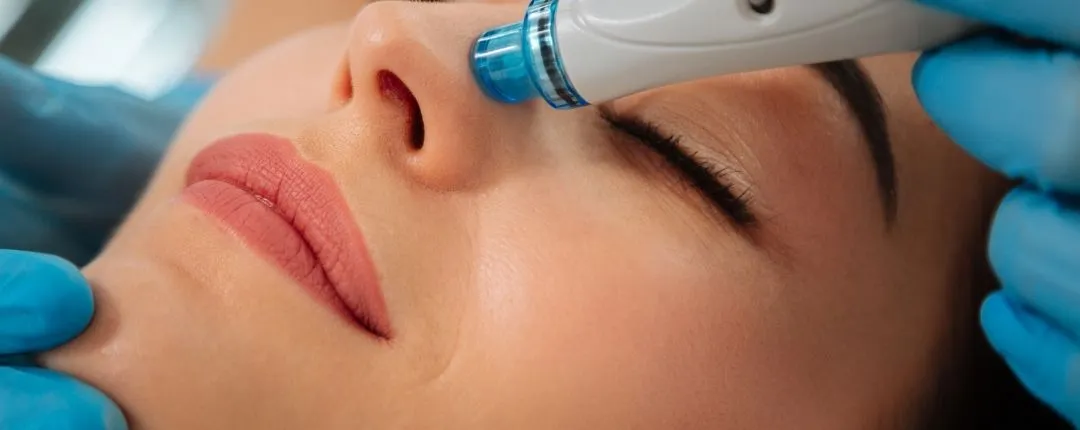 tratamiento HydraFacial en clínica estética para limpiar poros, hidratar la piel y mejorar la luminosidad facial
